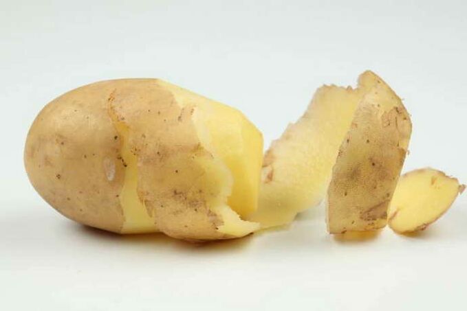 kartulid emakakaela osteokondroosi raviks