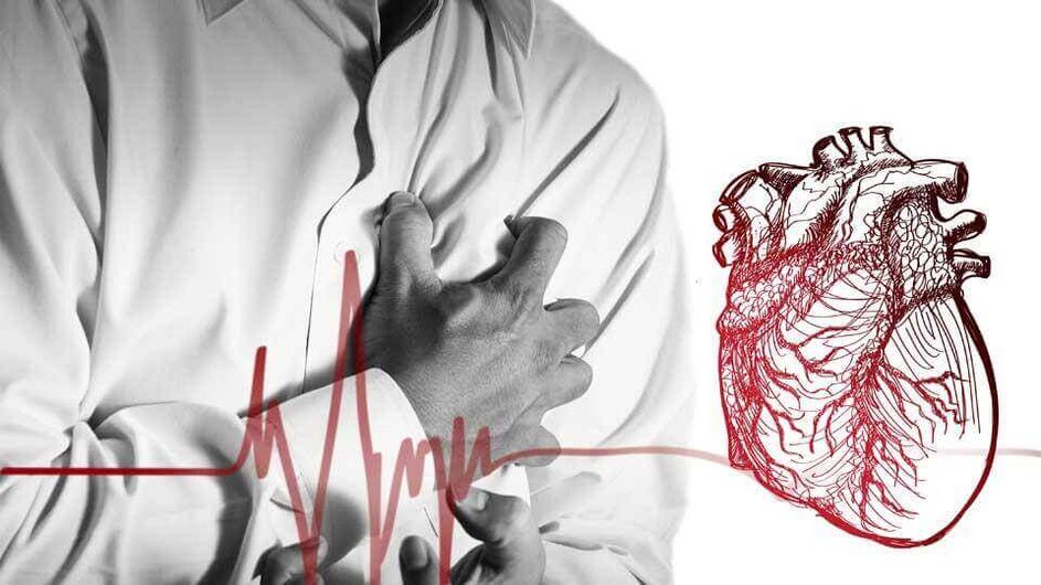 Rindkere osteokondroosi südame rütmihäirete tõttu võib tekkida ekstrasüstool