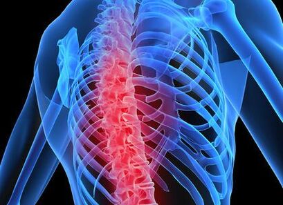 rindkere lülisamba osteokondroos