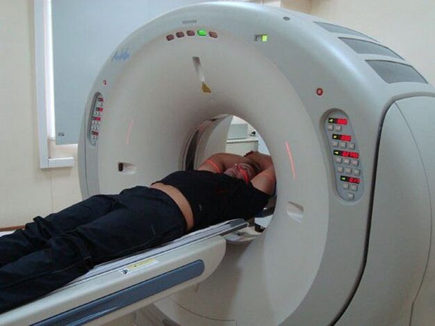 Osteokondroosi diagnoosimine